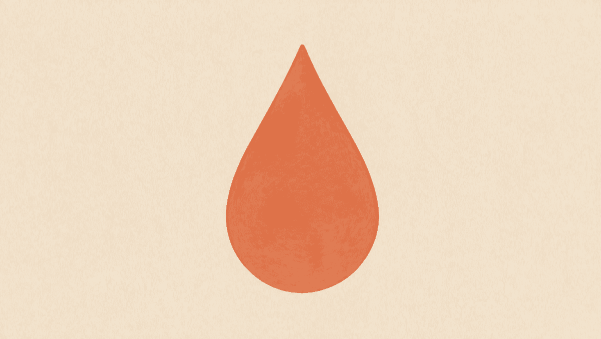 Blood in Urine Is Not Always a UTI: When to Work Up Bladder Cancer